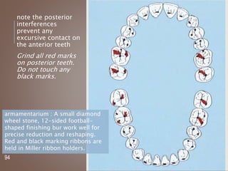 A TYPICAL PATTERN OF
MARKINGS WHEN A RED
RIBBON IS PLACED AND THE
PATIENT IS INSTRUCTED TO
GRIND THE TEETH TOGETHER.
note the posterior
interferences
prevent any
excursive contact on
the anterior teeth
Grind all red marks
on posterior teeth.
Do not touch any
black marks.
94
armamentarium : A small diamond
wheel stone, 12-sided football-
shaped finishing bur work well for
precise reduction and reshaping.
Red and black marking ribbons are
held in Miller ribbon holders.
 