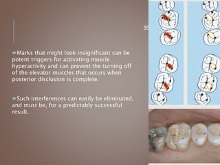 95
Marks that might look insignificant can be
potent triggers for activating muscle
hyperactivity and can prevent the turning off
of the elevator muscles that occurs when
posterior disclusion is complete.
Such interferences can easily be eliminated,
and must be, for a predictably successful
result.
 