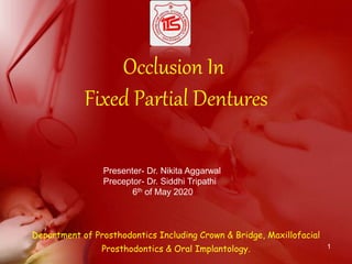 Occlusion In
Fixed Partial Dentures
Department of Prosthodontics Including Crown & Bridge, Maxillofacial
Prosthodontics & Oral Implantology. 1
Presenter- Dr. Nikita Aggarwal
Preceptor- Dr. Siddhi Tripathi
6th of May 2020
 