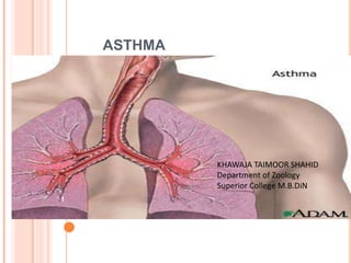 ASTHMA
1
KHAWAJA TAIMOOR SHAHID
Department of Zoology
Superior College M.B.DiN
 