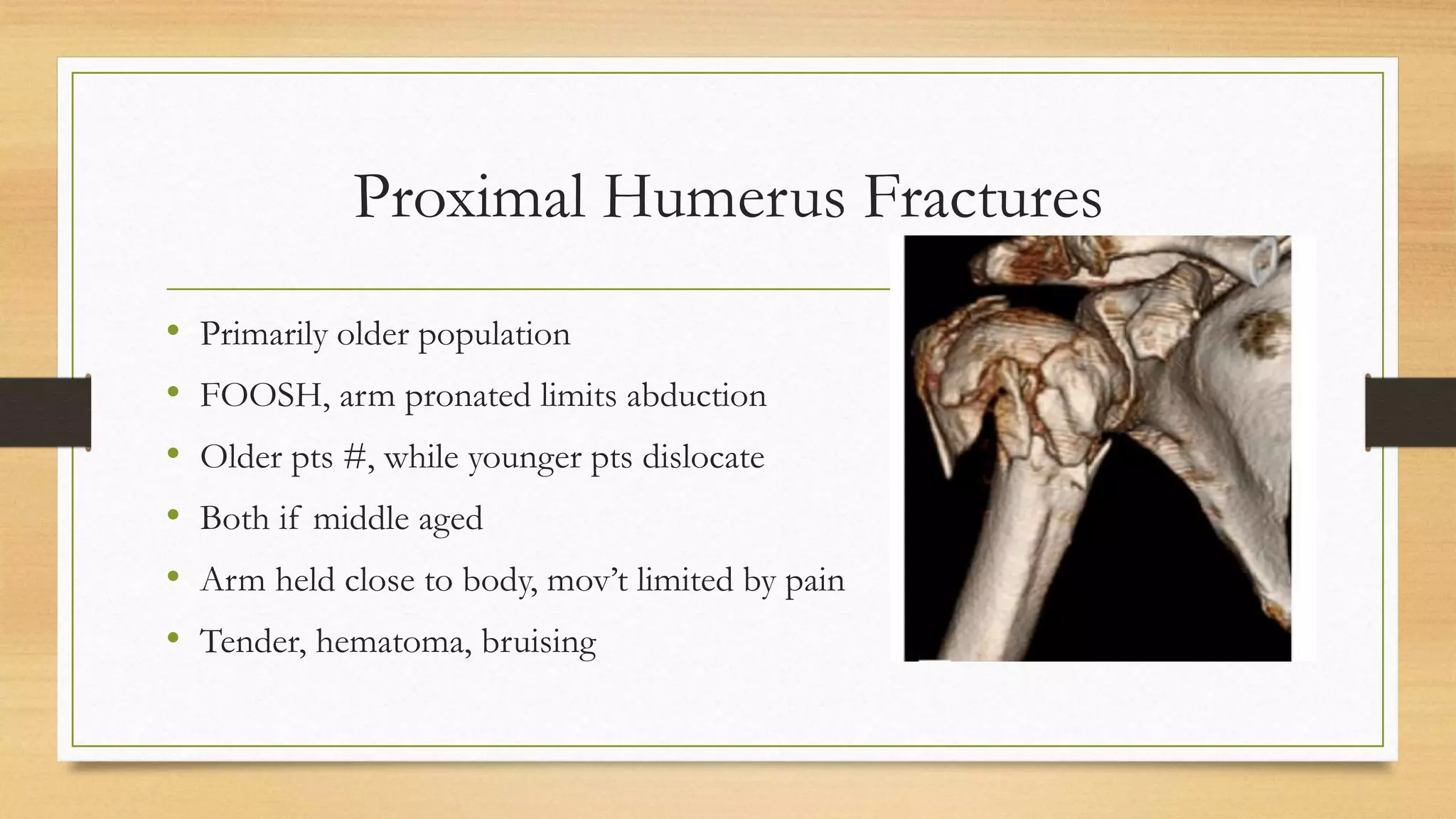 Humerus Fractures | PPTX