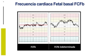 10. MONITORIZACION CARDIOFETAL.pptx