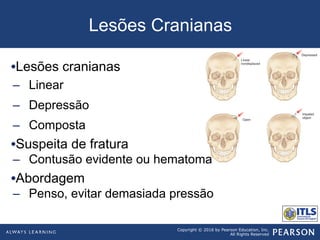 Copyright © 2016 by Pearson Education, Inc.
All Rights Reserved
Lesões Cranianas
• Lesões cranianas
–  Linear
–  Depressão
–  Composta
• Suspeita de fratura
–  Contusão evidente ou hematoma
• Abordagem
–  Penso, evitar demasiada pressão
 