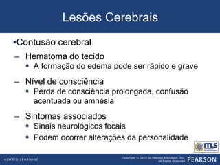 Copyright © 2016 by Pearson Education, Inc.
All Rights Reserved
Lesões Cerebrais
• Contusão cerebral
–  Hematoma do tecido
§  A formação do edema pode ser rápido e grave
–  Nível de consciência
§  Perda de consciência prolongada, confusão
acentuada ou amnésia
–  Sintomas associados
§  Sinais neurológicos focais
§  Podem ocorrer alterações da personalidade
 