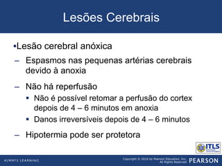 Copyright © 2016 by Pearson Education, Inc.
All Rights Reserved
Lesões Cerebrais
• Lesão cerebral anóxica
–  Espasmos nas pequenas artérias cerebrais
devido à anoxia
–  Não há reperfusão
§  Não é possível retomar a perfusão do cortex
depois de 4 – 6 minutos em anoxia
§  Danos irreversíveis depois de 4 – 6 minutos
–  Hipotermia pode ser protetora
 