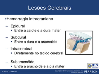 Copyright © 2016 by Pearson Education, Inc.
All Rights Reserved
Lesões Cerebrais
• Hemorragia intracraniana
–  Epidural
§  Entre a calote e a dura mater
–  Subdural
§  Entre a dura e a aracnóide
–  Intracerebral
§  Diretamente no tecido cerebral
–  Subaracnóide
§  Entra a aracnóide e a pia mater
 