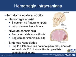 Copyright © 2016 by Pearson Education, Inc.
All Rights Reserved
Hemorragia Intracraniana
• Hematoma epidural súbito
–  Hemorragia arterial
§  É comum na fratura temporal
§  Inicio: de minutos a horas
–  Nível de consciência
§  Perda inicial da consciência
§  Seguida do “intervalo lúcido”
–  Sintomas Associados
§  Pupila dilatada e fixa do lado ipsilateral, sinais de
aumento da PIC, inconsciência, paralisia
contralateral, morte
 