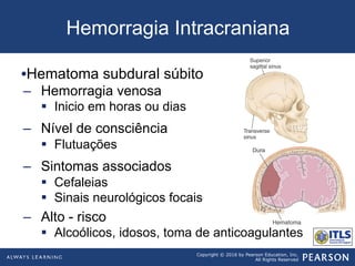 Copyright © 2016 by Pearson Education, Inc.
All Rights Reserved
Hemorragia Intracraniana
• Hematoma subdural súbito
–  Hemorragia venosa
§  Inicio em horas ou dias
–  Nível de consciência
§  Flutuações
–  Sintomas associados
§  Cefaleias
§  Sinais neurológicos focais
–  Alto - risco
§  Alcoólicos, idosos, toma de anticoagulantes
 