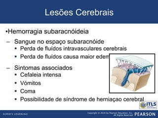 Copyright © 2016 by Pearson Education, Inc.
All Rights Reserved
• Hemorragia subaracnóideia
–  Sangue no espaço subaracnóide
§  Perda de fluídos intravasculares cerebrais
§  Perda de fluídos causa maior edema
–  Sintomas associados
§  Cefaleia intensa
§  Vómitos
§  Coma
§  Possibilidade de síndrome de herniaçao cerebral
Lesões Cerebrais
 