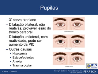 Copyright © 2016 by Pearson Education, Inc.
All Rights Reserved
Pupilas
–  3º nervo craniano
–  Dilatação bilateral, não
reativas, provável lesão do
tronco cerebral
–  Dilatação unilateral, com
reatividade, pode ser
aumento da PIC
–  Outras causas
§  Hipotermia
§  Estupefacientes
§  Anoxia
§  Trauma ocular
 