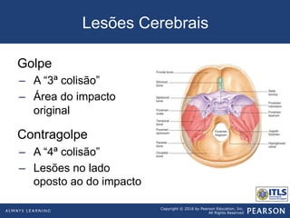 Copyright © 2016 by Pearson Education, Inc.
All Rights Reserved
Lesões Cerebrais
Golpe
–  A “3ª colisão”
–  Área do impacto
original
Contragolpe
–  A “4ª colisão”
–  Lesões no lado
oposto ao do impacto
 