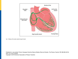 Fig. 1. Pathway of the cardiac impulse through the heart.
Published in: Lars-Jochen Thoms; Giuseppe Colicchia; Bianca Watzka; Raimund Girwidz; The Physics Teacher 57, 586-589 (2019)
DOI: 10.1119/1.5135782
Copyright © 2019 American Association of Physics Teachers
 