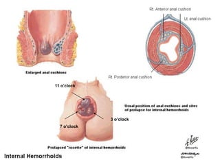 11 o’clock
7 o’clock
3 o’clock
 