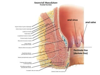 Pectinate line
(dentate line)
anal sinus
anal valve
 