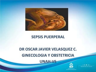 SEPSIS PUERPERAL
DR OSCAR JAVIER VELASQUEZ C.
GINECOLOGIA Y OBSTETRICIA
UNAH-VS
 
