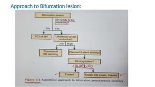Approach to Bifurcation lesion:
 