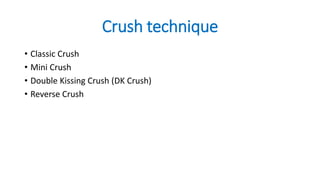 Crush technique
• Classic Crush
• Mini Crush
• Double Kissing Crush (DK Crush)
• Reverse Crush
 