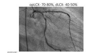 opLCX- 70-80%, dLCX- 40-50%
 