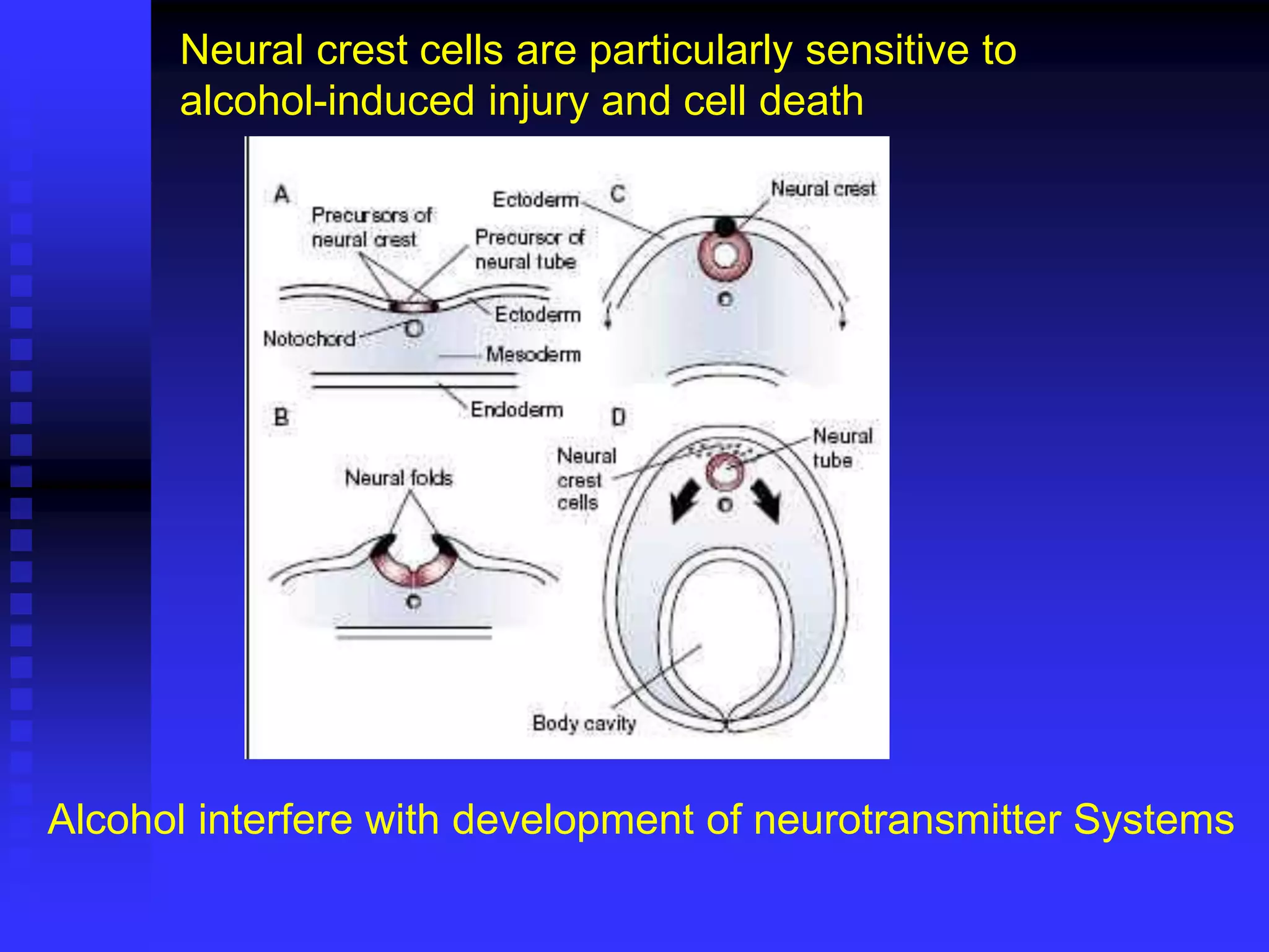 Neural crest cells are particularly sensitive to
alcohol-induced injury and cell death
Alcohol interfere with development of neurotransmitter Systems
 