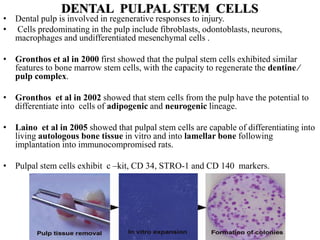 DENTAL PULPAL STEM CELLS
• Dental pulp is involved in regenerative responses to injury.
• Cells predominating in the pulp include fibroblasts, odontoblasts, neurons,
macrophages and undifferentiated mesenchymal cells .
• Gronthos et al in 2000 first showed that the pulpal stem cells exhibited similar
features to bone marrow stem cells, with the capacity to regenerate the dentine ⁄
pulp complex.
• Gronthos et al in 2002 showed that stem cells from the pulp have the potential to
differentiate into cells of adipogenic and neurogenic lineage.
• Laino et al in 2005 showed that pulpal stem cells are capable of differentiating into
living autologous bone tissue in vitro and into lamellar bone following
implantation into immunocompromised rats.
• Pulpal stem cells exhibit c –kit, CD 34, STRO-1 and CD 140 markers.
 