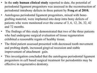 • In the only human clinical study reported to date, the potential of
periodontal ligament progenitors was assessed in the reconstruction of
periodontal intrabony defects in three patient by Feng et al 2010.
• Autologous periodontal ligament progenitors, mixed with bone-
grafting material, were implanted into deep intra bony defects of
patients who were monitored over the course of 3, 6, 12, 26, 32, 42
and 72 months.
• The findings of this study demonstrated that two of the three patients
who had undergone surgical evaluation of tissue regeneration
exhibited a reasonable regain of healthy tissue.
• The third patient assessed presented with decreased tooth movement
and probing depth, increased gingival recession and stable
improvement of attachment gain.
• This investigation concluded that the autologous periodontal ligament
progenitors in cell based surgical treatment for periodontitis may be
effective in regenerative dentistry.
 