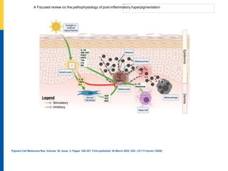 A Focused review on the pathophysiology of post‐inflammatory hyperpigmentation
Pigment Cell Melanoma Res, Volume: 35, Issue: 3, Pages: 320-327, First published: 20 March 2022, DOI: (10.1111/pcmr.13038)
 