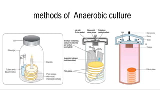methods of Anaerobic culture
 