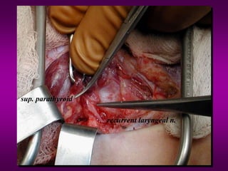 recurrent laryngeal n.
sup. parathyroid
 