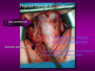 recurrent laryngeal n.
sup. parathyroid
Thyroid Cancer in Childhood
Challenges of Thyroid
Cancer Management
• No prospective randomized trials of treatment
• The prognosis is generally excellent
 