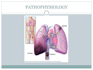 PATHOPHYSIOLOGY
 
