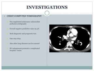 10. Pulmonary Embolism.pptx