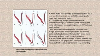 10.Dental Ceramics in restorative dentistry.pptx