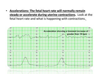 10.Antenatal Assesment of fetal well being (10).pptx