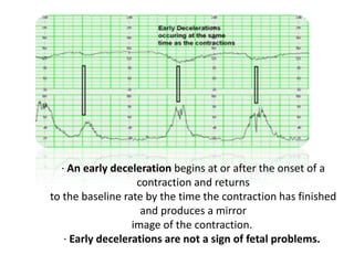 10.Antenatal Assesment of fetal well being (10).pptx