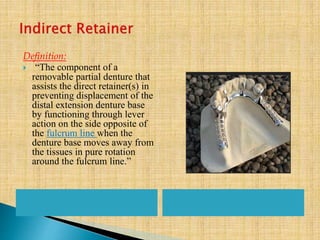 Definition:
 “The component of a
removable partial denture that
assists the direct retainer(s) in
preventing displacement of the
distal extension denture base
by functioning through lever
action on the side opposite of
the fulcrum line when the
denture base moves away from
the tissues in pure rotation
around the fulcrum line.”
 