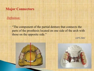 Definition:
◦ “The component of the partial denture that connects the
parts of the prosthesis located on one side of the arch with
those on the opposite side.”
◦ GPT-2001
 