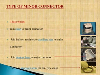  Those which:
 Join clasp to major connector
 Join indirect retainers or auxiliary rest to major
Connector
 Join denture base to major connector
 Serve as approach arms for bar- type clasp
 