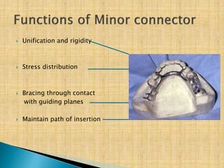  Unification and rigidity
 Stress distribution
 Bracing through contact
with guiding planes
 Maintain path of insertion
 
