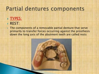  TYPES:
 REST:
 The components of a removable partial denture that serve
primarily to transfer forces occurring against the prosthesis
down the long axis of the abutment teeth are called rests
 