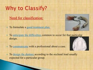 Need for classification:
 To formulate a good treatment plan.
 To anticipate the difficulties common to occur for that particular
design.
 To communicate with a professional about a case.
 To design the denture according to the occlusal load usually
expected for a particular group.
 