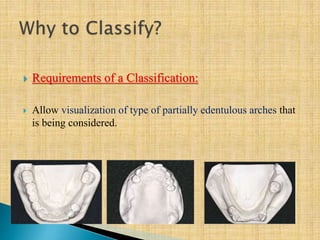  Requirements of a Classification:
 Allow visualization of type of partially edentulous arches that
is being considered.
 