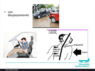 • con
desplazamiento
 