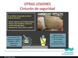 OTRAS LESIONES
Cinturón de seguridad
 