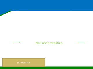 Nail abnormalities
Dr. Bashir nur
 