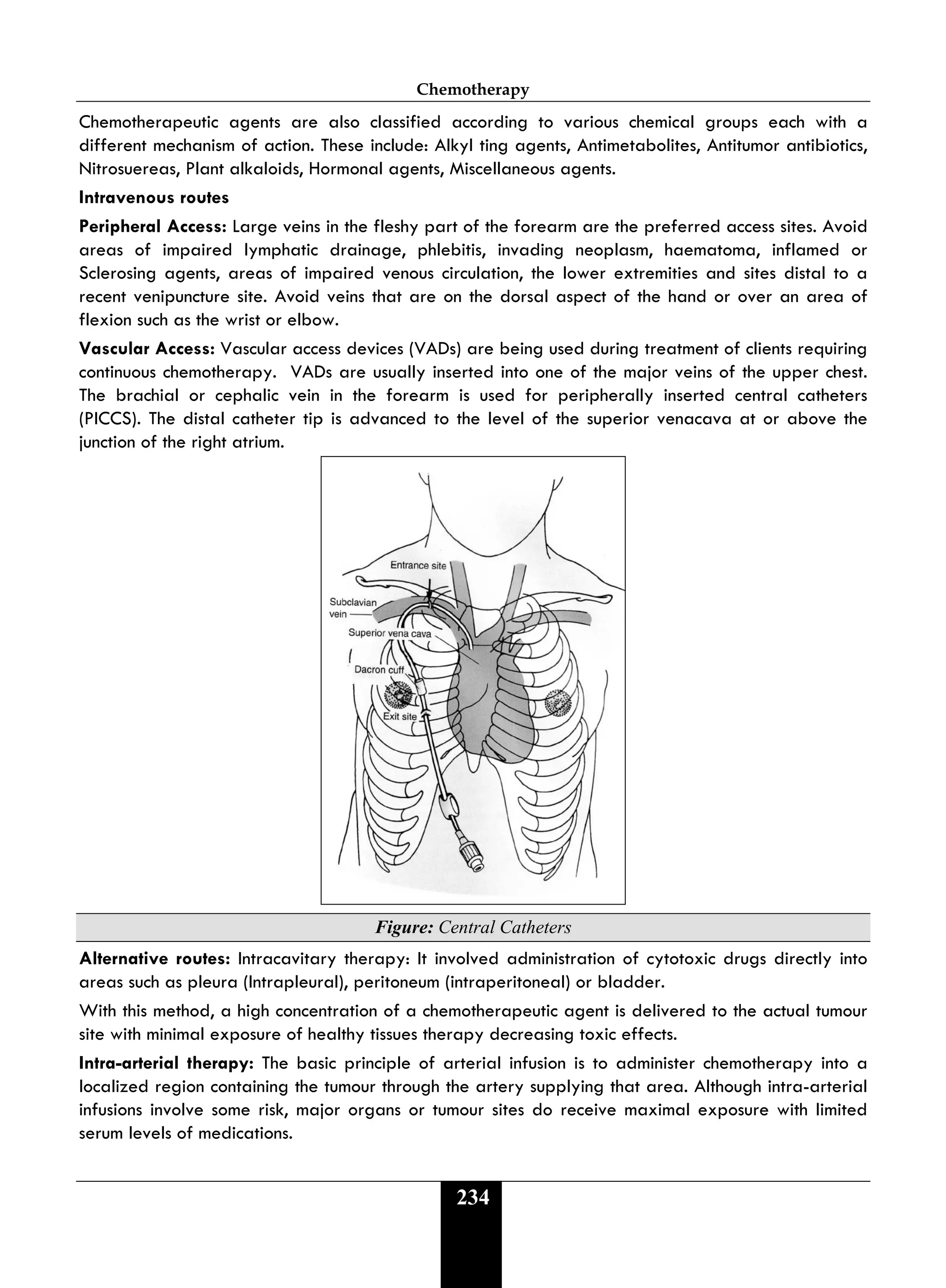 Chemotherapy
234
Chemotherapeutic agents are also classified according to various chemical groups each with a
different mechanism of action. These include: Alkyl ting agents, Antimetabolites, Antitumor antibiotics,
Nitrosuereas, Plant alkaloids, Hormonal agents, Miscellaneous agents.
Intravenous routes
Peripheral Access: Large veins in the fleshy part of the forearm are the preferred access sites. Avoid
areas of impaired lymphatic drainage, phlebitis, invading neoplasm, haematoma, inflamed or
Sclerosing agents, areas of impaired venous circulation, the lower extremities and sites distal to a
recent venipuncture site. Avoid veins that are on the dorsal aspect of the hand or over an area of
flexion such as the wrist or elbow.
Vascular Access: Vascular access devices (VADs) are being used during treatment of clients requiring
continuous chemotherapy. VADs are usually inserted into one of the major veins of the upper chest.
The brachial or cephalic vein in the forearm is used for peripherally inserted central catheters
(PICCS). The distal catheter tip is advanced to the level of the superior venacava at or above the
junction of the right atrium.
Figure: Central Catheters
Alternative routes: Intracavitary therapy: It involved administration of cytotoxic drugs directly into
areas such as pleura (Intrapleural), peritoneum (intraperitoneal) or bladder.
With this method, a high concentration of a chemotherapeutic agent is delivered to the actual tumour
site with minimal exposure of healthy tissues therapy decreasing toxic effects.
Intra-arterial therapy: The basic principle of arterial infusion is to administer chemotherapy into a
localized region containing the tumour through the artery supplying that area. Although intra-arterial
infusions involve some risk, major organs or tumour sites do receive maximal exposure with limited
serum levels of medications.
 