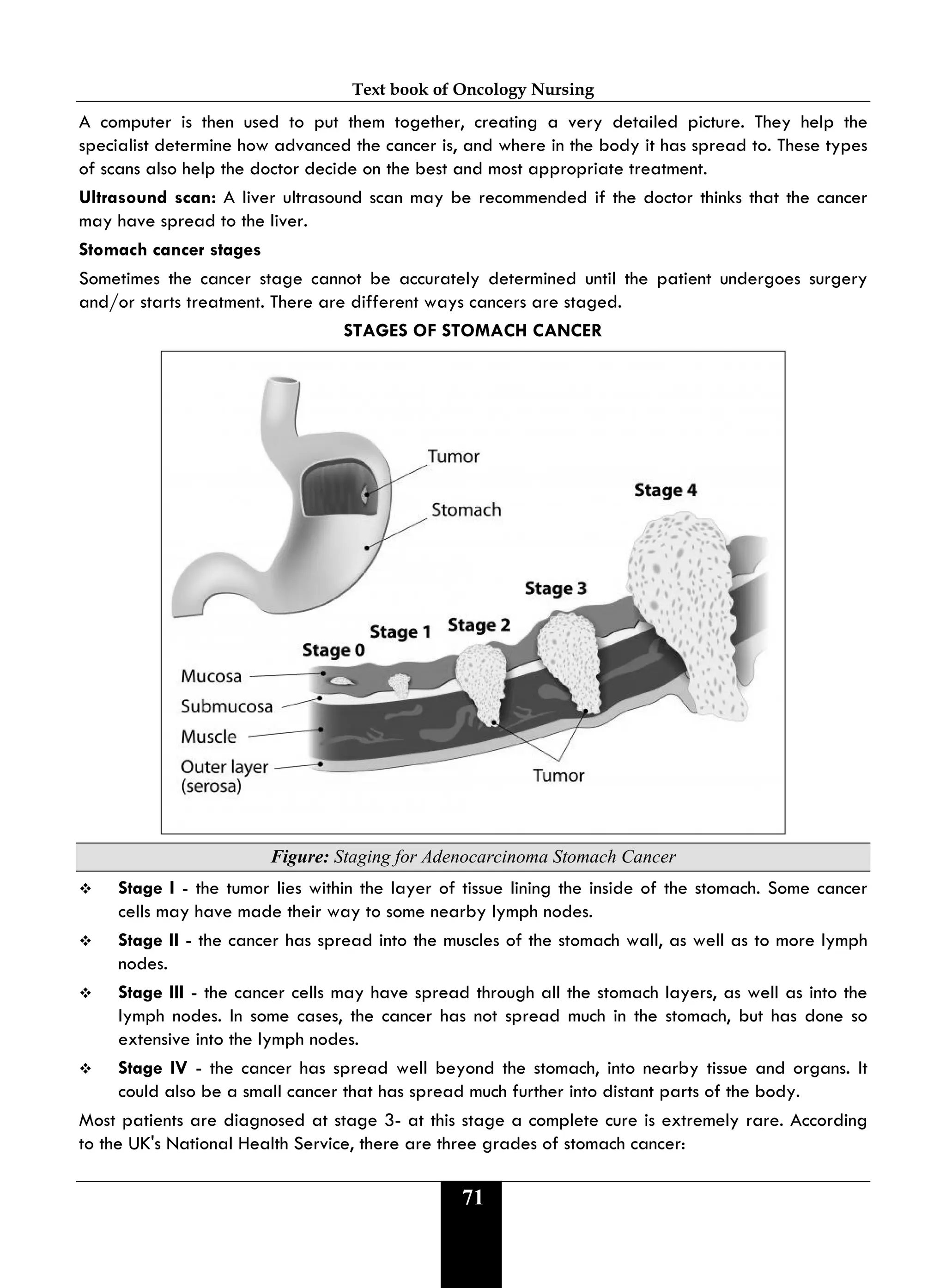Text book of Oncology Nursing
71
A computer is then used to put them together, creating a very detailed picture. They help the
specialist determine how advanced the cancer is, and where in the body it has spread to. These types
of scans also help the doctor decide on the best and most appropriate treatment.
Ultrasound scan: A liver ultrasound scan may be recommended if the doctor thinks that the cancer
may have spread to the liver.
Stomach cancer stages
Sometimes the cancer stage cannot be accurately determined until the patient undergoes surgery
and/or starts treatment. There are different ways cancers are staged.
STAGES OF STOMACH CANCER
Figure: Staging for Adenocarcinoma Stomach Cancer
 Stage I - the tumor lies within the layer of tissue lining the inside of the stomach. Some cancer
cells may have made their way to some nearby lymph nodes.
 Stage II - the cancer has spread into the muscles of the stomach wall, as well as to more lymph
nodes.
 Stage III - the cancer cells may have spread through all the stomach layers, as well as into the
lymph nodes. In some cases, the cancer has not spread much in the stomach, but has done so
extensive into the lymph nodes.
 Stage IV - the cancer has spread well beyond the stomach, into nearby tissue and organs. It
could also be a small cancer that has spread much further into distant parts of the body.
Most patients are diagnosed at stage 3- at this stage a complete cure is extremely rare. According
to the UK's National Health Service, there are three grades of stomach cancer:
 