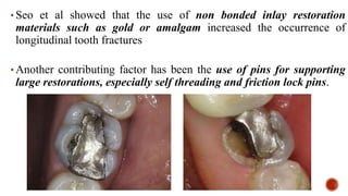 • Seo et al showed that the use of non bonded inlay restoration
materials such as gold or amalgam increased the occurrence of
longitudinal tooth fractures
• Another contributing factor has been the use of pins for supporting
large restorations, especially self threading and friction lock pins.
 