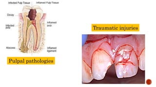Pulpal pathologies
Traumatic injuries
 