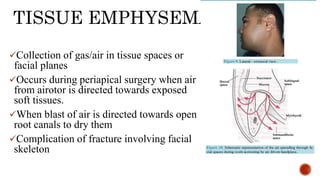 TISSUE EMPHYSEMA
Collection of gas/air in tissue spaces or
facial planes
Occurs during periapical surgery when air
from airotor is directed towards exposed
soft tissues.
When blast of air is directed towards open
root canals to dry them
Complication of fracture involving facial
skeleton
 