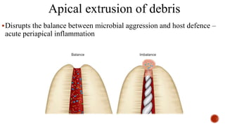 Apical extrusion of debris
Disrupts the balance between microbial aggression and host defence –
acute periapical inflammation
 